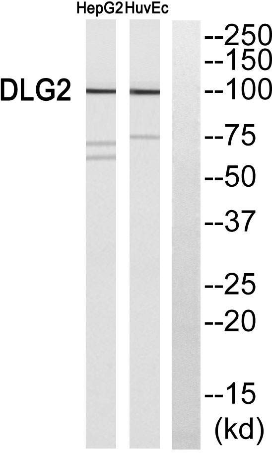 Western blot analysis of DLG2 Antibody