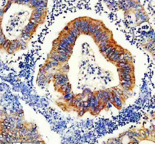 IHC analysis of PDHX using anti-PDHX antibody (A04836-2)