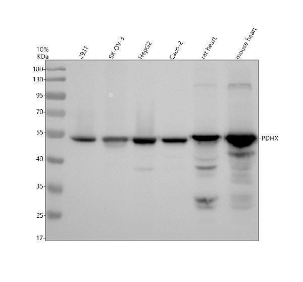 Western blot analysis of PDHX using anti-PDHX antibody (A04836-2)