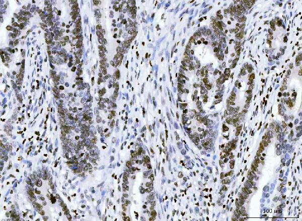 a04839 2 hmgn2 primary antibodies ihc testing 2