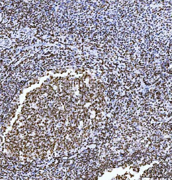 a04839 2 hmgn2 primary antibodies ihc testing 3