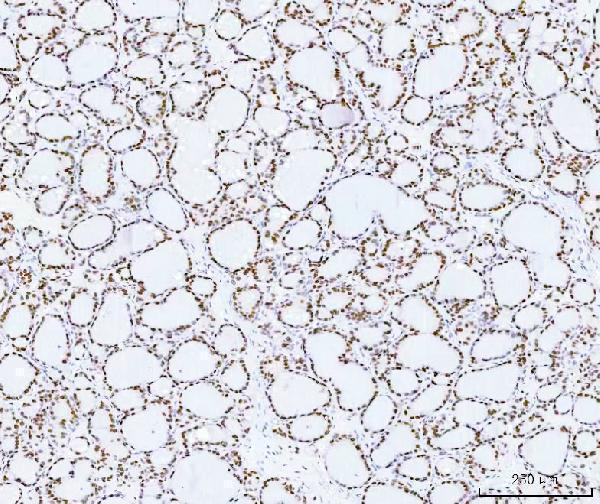 a04839 2 hmgn2 primary antibodies ihc testing 4