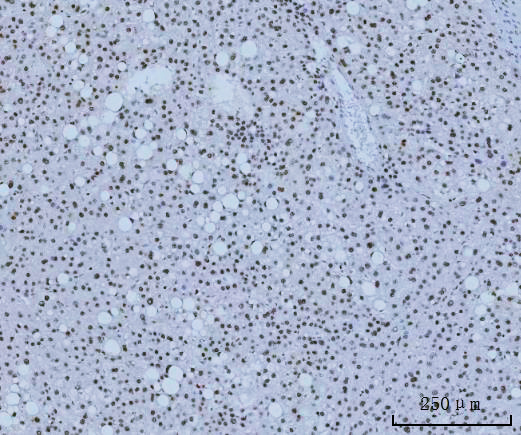 a04839 2 hmgn2 primary antibodies ihc testing 5