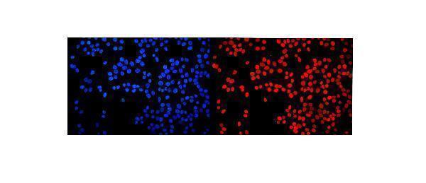 a04839 2 hmgn2 primary antibodies ihc testing 6