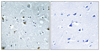 a04839s29 hmgn2 primary antibodies ihc testing 1
