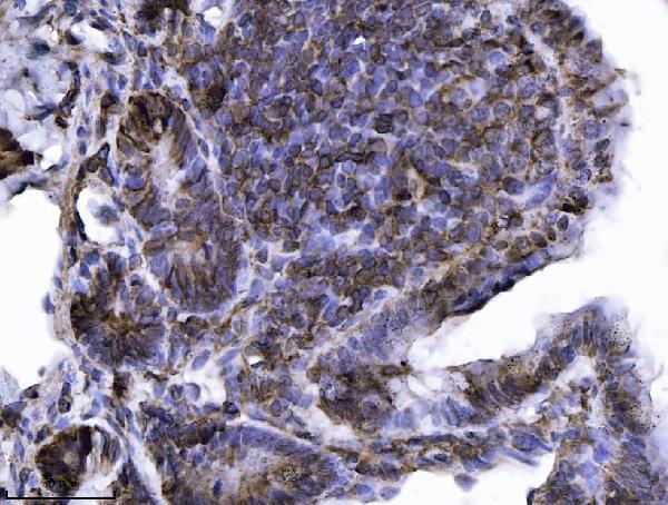  IHC analysis of Annexin-4/ANXA4 using anti-Annexin-4/ANXA4 antibody (A04840-2)