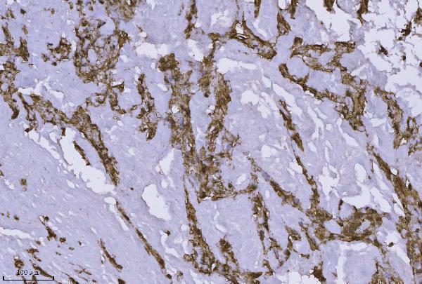  IHC analysis of Annexin-4/ANXA4 using anti-Annexin-4/ANXA4 antibody (A04840-2)
