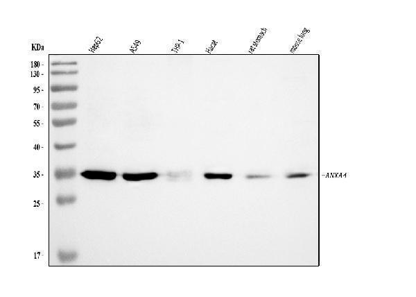  Western blot analysis of Annexin-4/ANXA4 using anti-Annexin-4/ANXA4 antibody (A04840-2)