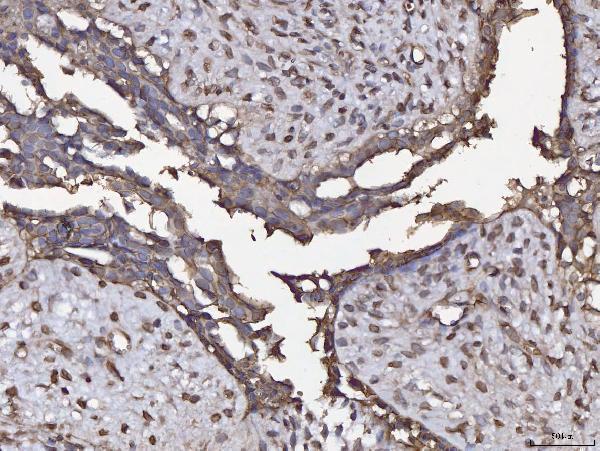  IHC analysis of ANXA4 using anti-ANXA4 antibody (A04840)