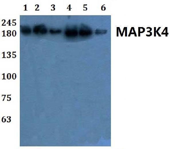 a04842 1 map3k4 primary antiboties wb testing 1