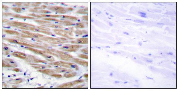 Immunohistochemistry analysis of paraffin-embedded human heart tissue, using MAP3K4 Antibody