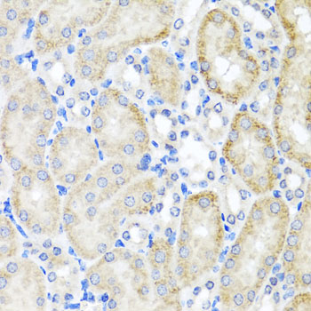 Immunohistochemistry of paraffin-embedded mouse kidney using PSTPIP1 antibody at dilution of 1:100 (x40 lens)