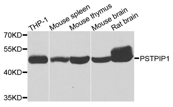 Western blot analysis of extracts of various cells, using PSTPIP1 antibody