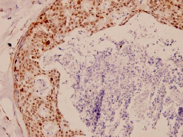 a04850 1 tk1 primary antiboties ihc testing 2