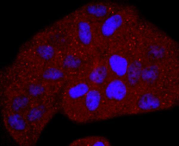 ICC staining Thymidine Kinase 1 in Hela cells (red)