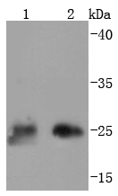 Western blot analysis of Thymidine Kinase 1 on different lysates using anti-Thymidine Kinase 1 antibody at 1/1,000 dilution