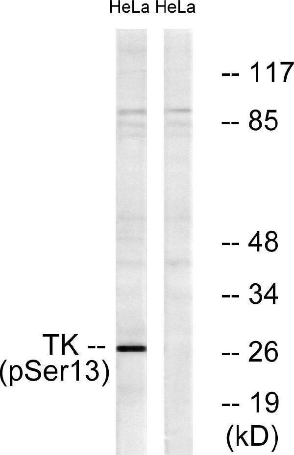 Western blot analysis of lysates from HeLa cells treated with paclitaxel 1uM 24h, using TK (Phospho-Ser13) Antibody