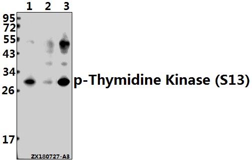 a04850s13 tk1 primary antiboties wb testing 1