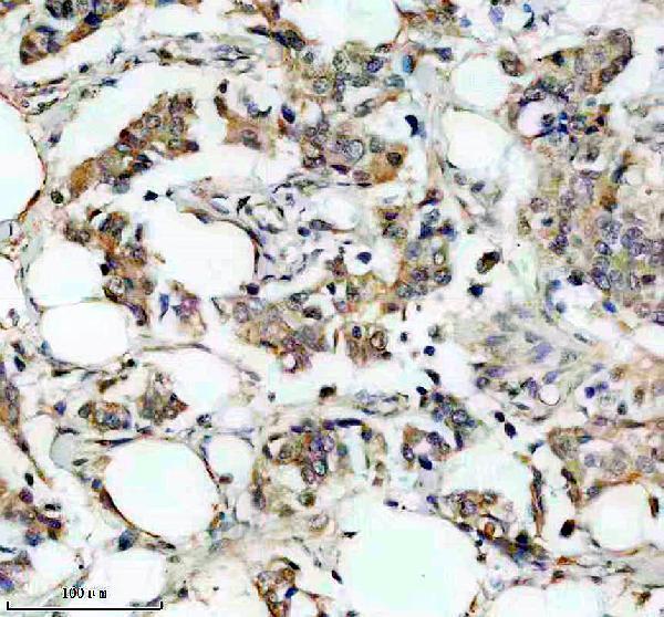 IHC analysis of SEMA3F using anti-SEMA3F antibody (A04851-1)