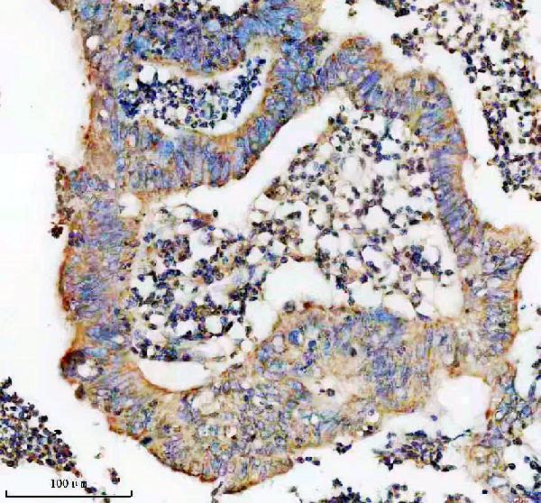 IHC analysis of SEMA3F using anti-SEMA3F antibody (A04851-1)