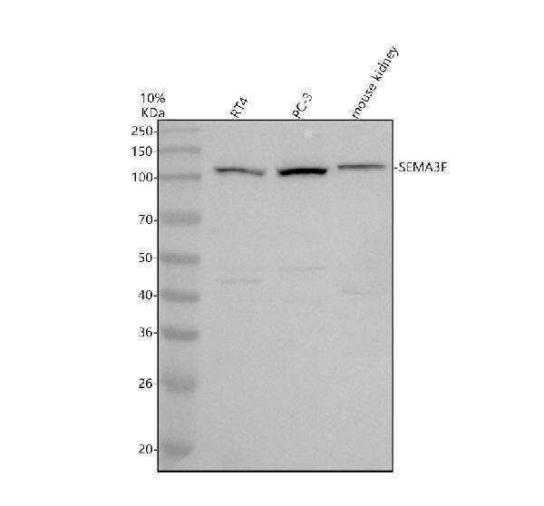 Western blot analysis of SEMA3F using anti-SEMA3F antibody (A04851-1)