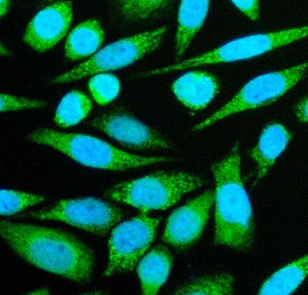 a04852 1 sec63 primary antibodies if testing 2