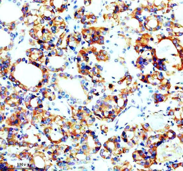 IHC analysis of SEC63 using anti-SEC63 antibody (A04852-1)