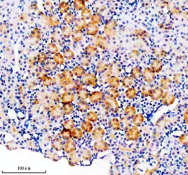IHC analysis of SEC63 using anti-SEC63 antibody (A04852-1)