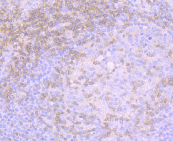 Immunohistochemical analysis of paraffin-embedded human tonsil tissue using anti-CD3G antibody