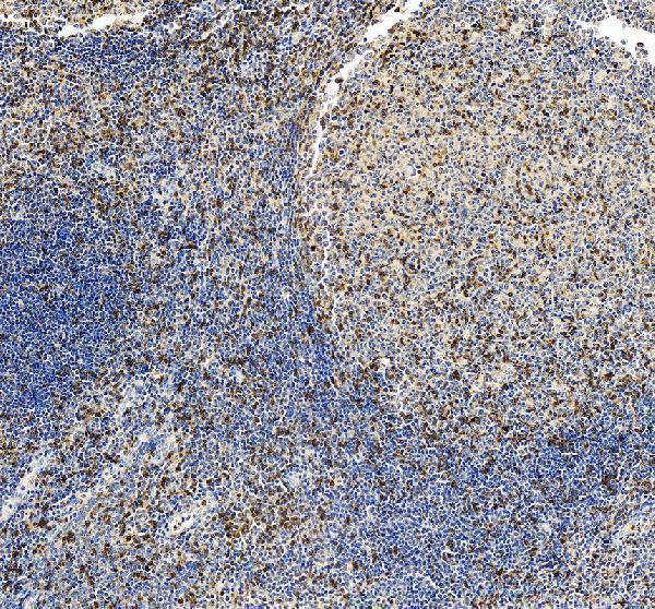IHC analysis of CD3 Gamma/CD3G using anti-CD3 Gamma/CD3G antibody (A04853-2)