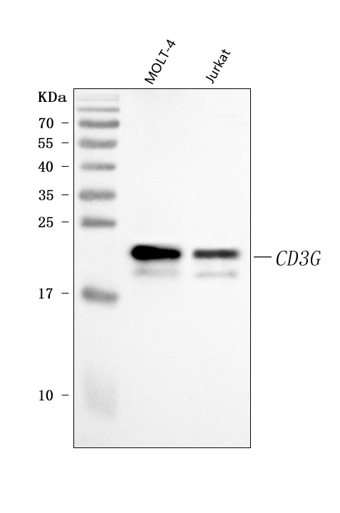  Western blot analysis of CD3 Gamma/CD3G using anti-CD3 Gamma/CD3G antibody (A04853-2)