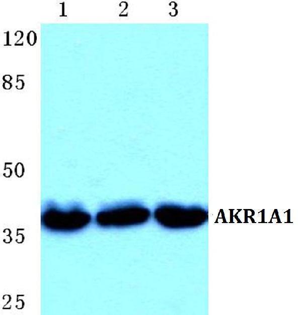 Western blot (WB) analysis of AKR1A1 polyclonal antibody at 1:500 dilution
Lane1:Hela cell lysate
Lane2:Raw264