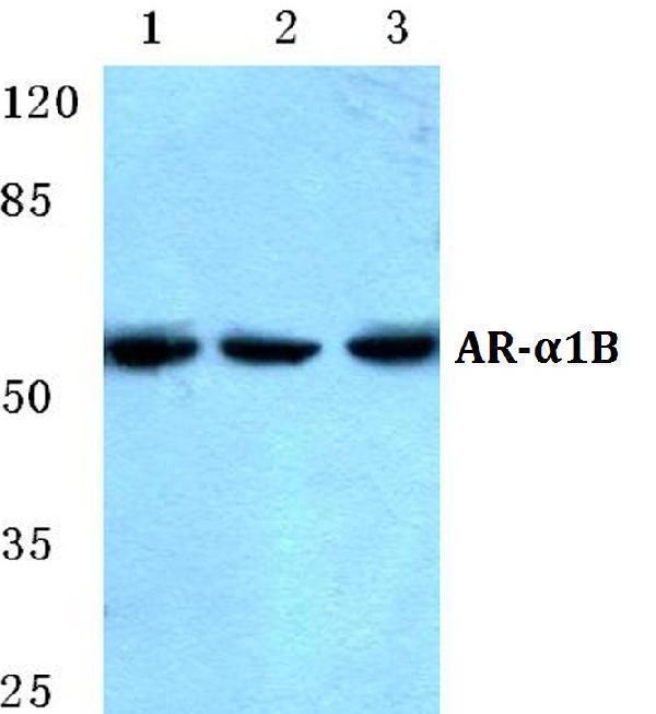 Western blot (WB) analysis of AR-α1B polyclonal antibody at 1:500 dilution
Lane1:A549 cell lysate
Lane2:HEK293T cell lysate
Lane3:PC12 cell lysate
