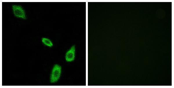 Immunofluorescence analysis of LOVO cells, using ADRA1B Antibody