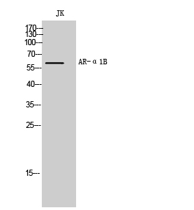 Western blot analysis of JK cells using AR-Alpha 1B Polyclonal Antibody