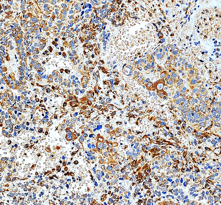 IHC analysis of OTUD7B using anti-OTUD7B antibody (A04857)