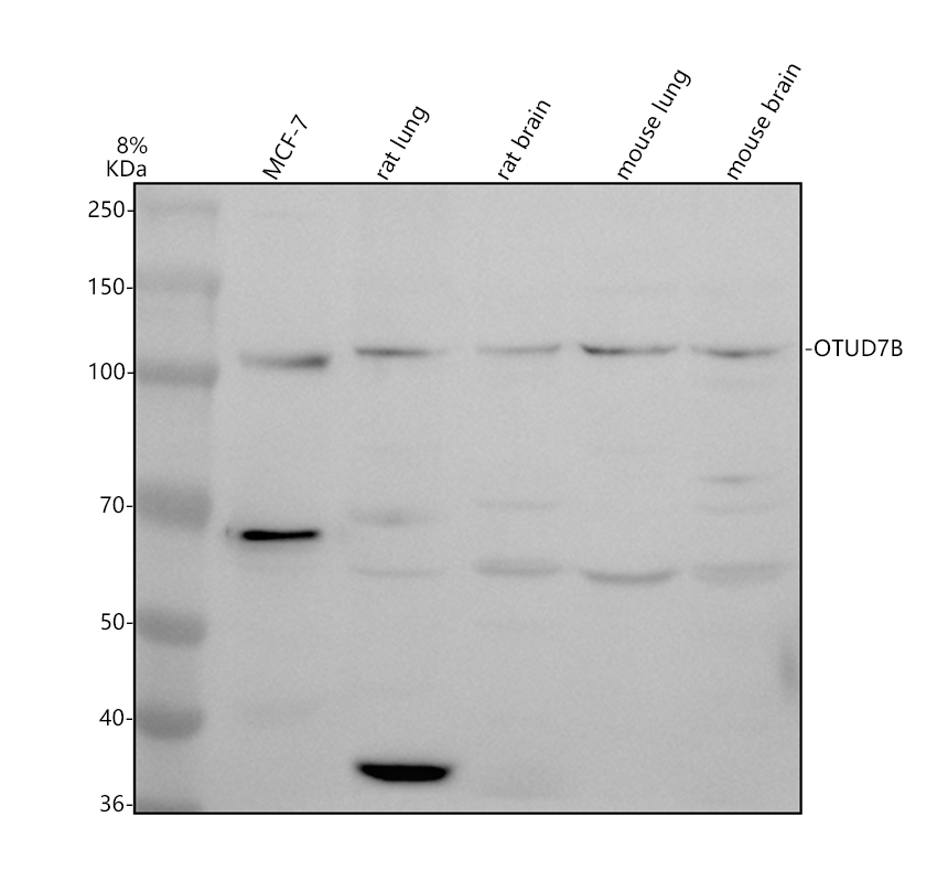 Western blot analysis of OTUD7B using anti-OTUD7B antibody (A04857)