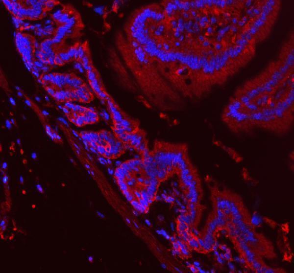 a04859 1 aph1a primary antibodies if testing 1