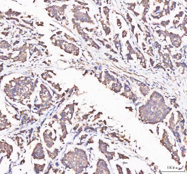  IHC analysis of APH1A using anti-APH1A antibody (A04859-1)
