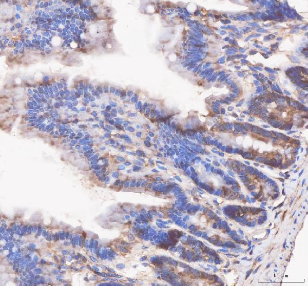  IHC analysis of APH1A using anti-APH1A antibody (A04859-1)