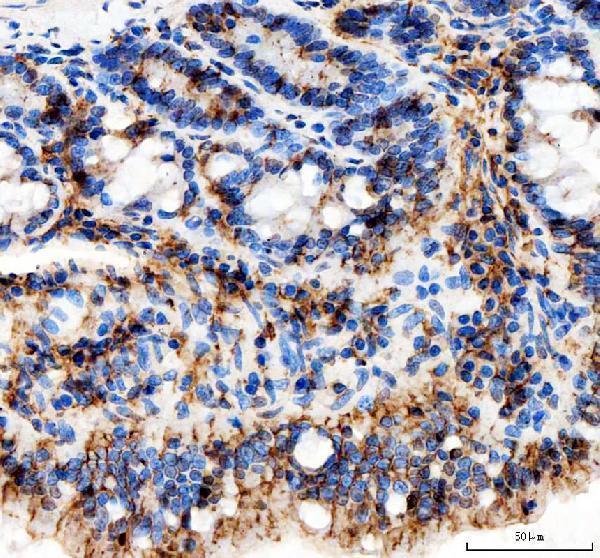 a04859 1 aph1a primary antibodies ihc testing 4