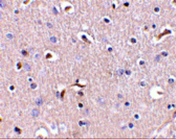 a04859 aph1a primary antibodies ihc testing 2