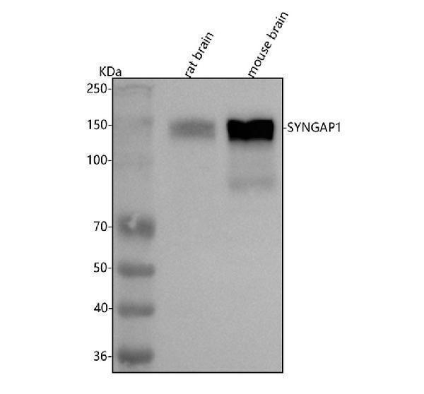  Western blot analysis of SYNGAP1 using anti-SYNGAP1 antibody (A04862-1)