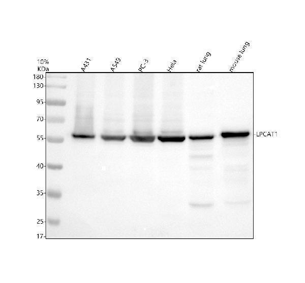 Western blot analysis of LPCAT1 using anti-LPCAT1 antibody (A04863-1)