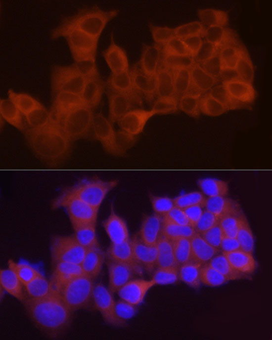 Immunofluorescence analysis of MCF7 cells using LPCAT1 Rabbit pAb  at dilution of 1:50 