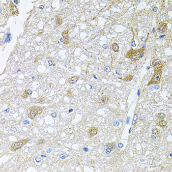 Immunohistochemistry of paraffin-embedded rat brain using RAPSN antibody  at dilution of 1:100 