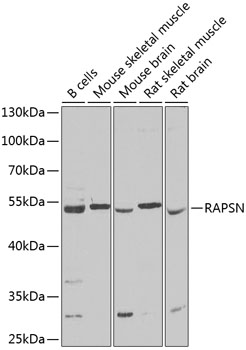 Western blot analysis of extracts of various cell lines, using RAPSN Antibody  at 1:1000 dilution
