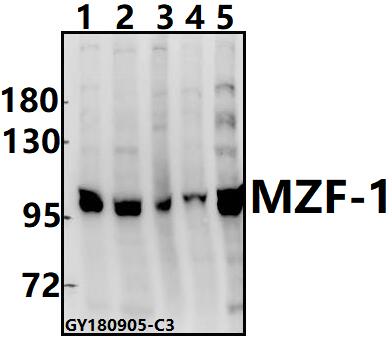 Western blot (WB) analysis of MZF-1 (D10) pAb at 1:500 dilution
Lane1:MG63 whole cell lysate(30ug)
Lane2:Panc1 whole cell lysate(40ug)
Lane3:C6 whole cell lysate(40ug)
Lane4:3T3-L1 whole cell lysate(40ug)
Lane5:K562 whole cell lysate(40ug)