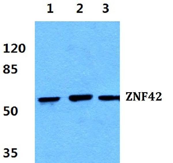 Western blot (WB) analysis of ZNF42 polyclonal antibody at 1:500 dilution
Lane1:HEK293T cell lysate
Lane2:sp2/0 cell lysate
Lane3:PC12 cell lyate