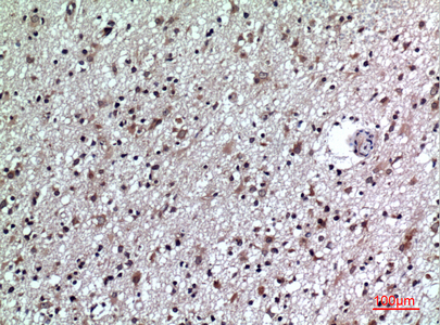 Immunohistochemical analysis of paraffin-embedded human-brain, antibody was diluted at 1:100